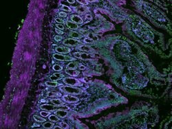 CellMask Deep Red Actin Tracking Stain labeling in IHC protocol
