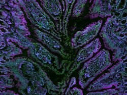 CellMask Deep Red Actin Tracking Stain labeling in IHC protocol
