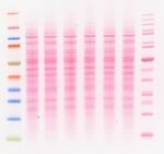 丽春红 S 染色液