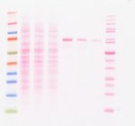 丽春红 S 染色液