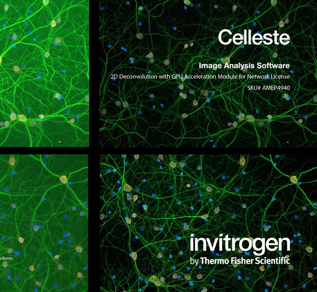 带有 GPU 加速模块的 Celleste&trade; 2D 反卷积，网络许可证