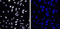 HeLa cells labeled with 1:2000 HCS NuclearMask™ Blue Stain