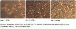 Phase contrast images of human epidermal keratinocytes (HEKa) grown in culture.