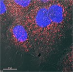 pHrodo&trade; Red 和 Green 葡聚糖，10,000 MW，用于检测内吞作用