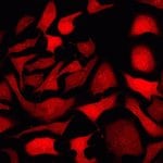 pHrodo&trade; Red and Green AM Intracellular pH Indicator Dyes