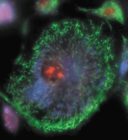 Live bovine pulmonary artery endothelial cells (BPAEC) stained with dihydroethidium and MitoTracker Green FM.