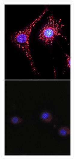 Detection of superoxide in live cells using MitoSOX™ Red superoxide indicator.
