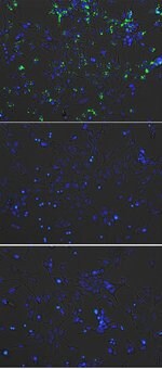 来自人血浆的低密度脂蛋白、pHrodo&trade; Green-LDL 和 Red-LDL 偶联物