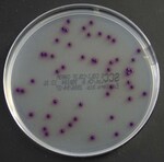 Brilliance&trade; E. coli / Coliform Selective Agar