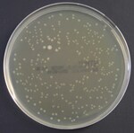 Haemophilus Test Medium (HTM)