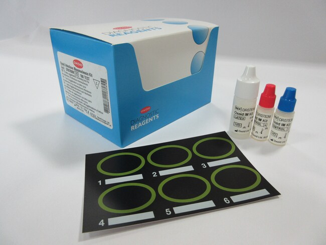 Infectious Mononucleosis Test using Latex Agglutination