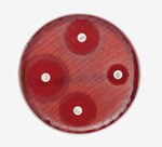 Mueller-Hinton Agar with 5% Sheep Blood