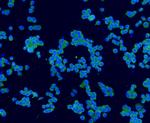 Synaptophysin Antibody in Immunocytochemistry (ICC/IF)