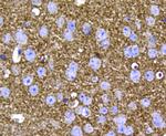 Synaptophysin Antibody in Immunohistochemistry (Paraffin) (IHC (P))