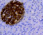 Synaptophysin Antibody in Immunohistochemistry (Paraffin) (IHC (P))