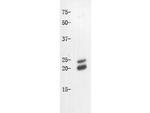 Caveolin-1 Antibody in Western Blot (WB)