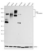 CD56 Antibody in Western Blot (WB)