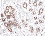 ESR1 Antibody in Immunohistochemistry (Paraffin) (IHC (P))