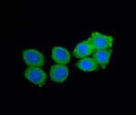 Noggin Antibody in Immunocytochemistry (ICC/IF)