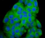 Noggin Antibody in Immunocytochemistry (ICC/IF)