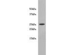 Noggin Antibody in Western Blot (WB)