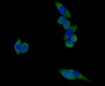 Carcino Embryonic Antigen CEA Antibody in Immunocytochemistry (ICC/IF)