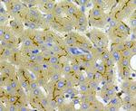 Carcino Embryonic Antigen CEA Antibody in Immunohistochemistry (Paraffin) (IHC (P))