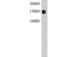 Carcino Embryonic Antigen CEA Antibody in Western Blot (WB)