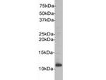 Beta-2 Microglobulin Antibody in Western Blot (WB)