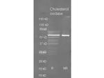 Cholesterol Oxidase Antibody in Western Blot (WB)