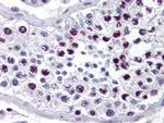 Cyclin A Antibody in Immunohistochemistry (Paraffin) (IHC (P))