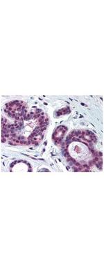 cdk2 Antibody in Immunohistochemistry (Paraffin) (IHC (P))