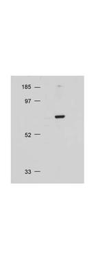 AKT Antibody in Western Blot (WB)