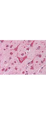 CaM Kinase IV Antibody in Immunohistochemistry (Paraffin) (IHC (P))