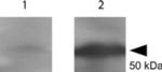 Tetanus Toxic Fragment C Antibody in Western Blot (WB)