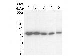 Tetanus Toxic Fragment C Antibody in Western Blot (WB)