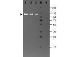 beta Galactosidase Antibody in Western Blot (WB)