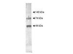 Alcohol Dehydrogenase Antibody in Western Blot (WB)