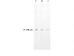 Thymidylate Synthase Antibody in Western Blot (WB)