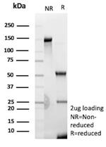 N-Cadherin/Cadherin-2/CD325 (NCAD) Antibody in SDS-PAGE (SDS-PAGE)
