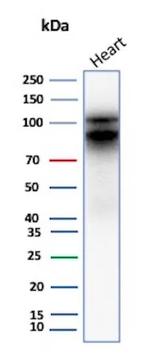 N-Cadherin/Cadherin-2/CD325 (NCAD) Antibody in Western Blot (WB)