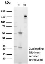 N-Cadherin/Cadherin-2/CD325 (NCAD) Antibody in SDS-PAGE (SDS-PAGE)