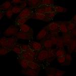 N-Cadherin/Cadherin-2/CD325 (NCAD) Antibody in SDS-PAGE (SDS-PAGE)