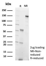 N-Cadherin/Cadherin-2/CD325 (NCAD) Antibody in SDS-PAGE (SDS-PAGE)