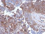N-Cadherin/Cadherin-2/CD325 (NCAD) Recombinant Rabbit Monoclonal Antibody (CDH2/6857R)