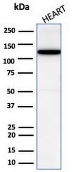 N-Cadherin/Cadherin-2/CD325 (NCAD) Antibody in Western Blot (WB)