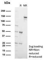 P-Cadherin (CDH3) (Basal Epithelial Cell Marker) Antibody in SDS-PAGE (SDS-PAGE)