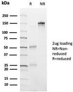 HDAC6 Antibody in SDS-PAGE (SDS-PAGE)