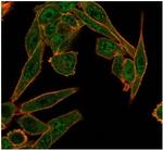 HDAC6 Antibody in Immunocytochemistry (ICC/IF)