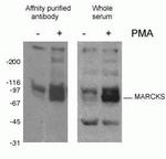 Phospho-MARCKS (Ser93, Ser97, Ser104) Antibody in Western Blot (WB)